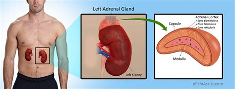 Addison S Disease Or Hypocortisolism Or Hypoadrenalism Addisons Disease Addison S Disease