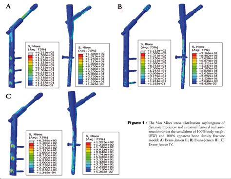 Figure From Biomechanical Comparison Of Internal Fixations In