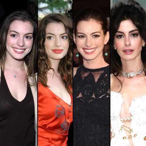 Has Anne Hathaway Undergone Plastic Surgery See Her Transformation