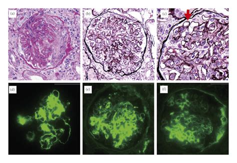 Light Microscopic Appearance Periodic Acidschiff Pas Staining