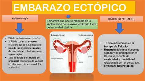 Embarazo Ectópico Medicina Apuntes de medicina uDocz