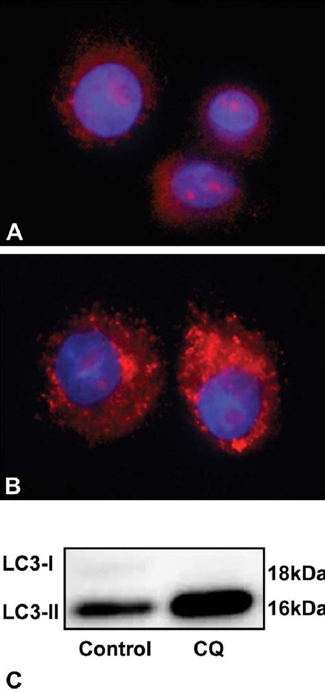 —h838 Cells Treated In Vitro With Distilled Water A Or Chloroquine Download Scientific