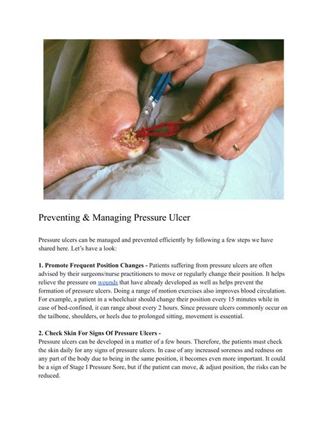 Ppt How To Manage And Prevent Pressure Ulcers Powerpoint Presentation