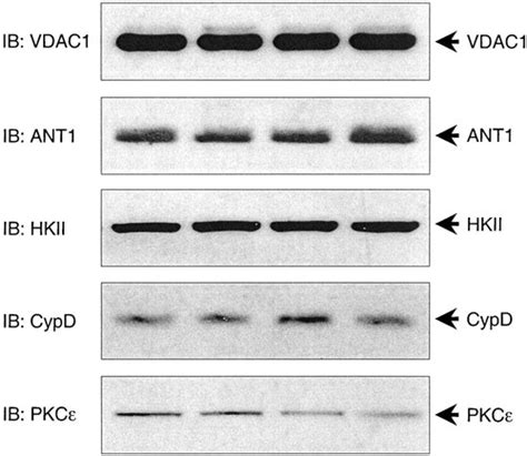 Protein Kinase C Interacts With And Inhibits The Permeability