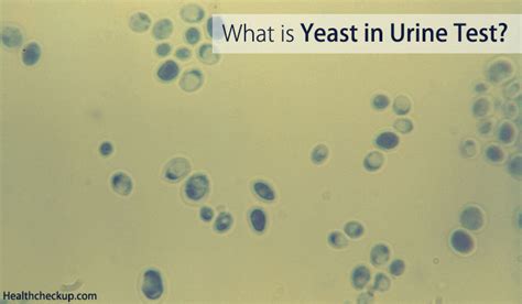 Yeast In Urine Test What Does Yeast Cells In Urine Mean