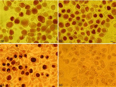 Iodine Stained Inclusions Of The C Trachomatis Strains Nvct Sweden2 Download Scientific