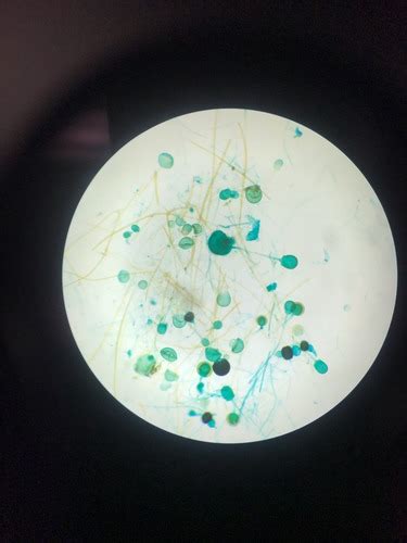 Ch Fungi N Lichens Flashcards Quizlet