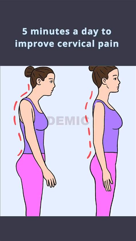 Forward Head Posture Exercises To Reduce Neck Pain Artofit