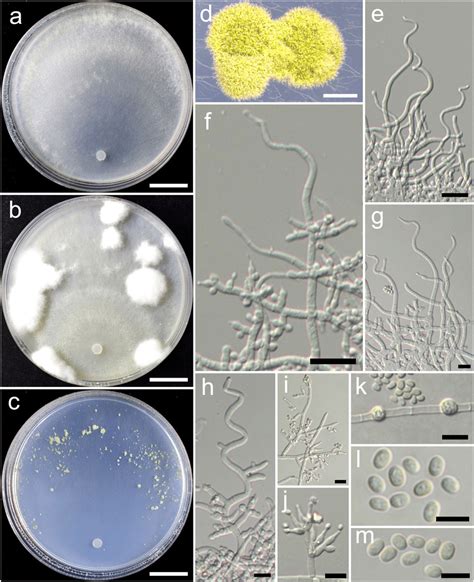 Trichoderma Byssinum HMAS 248838 A C Cultures At 25 C 10 D A