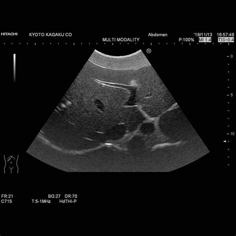 Dual Modality Human Abdomen Phantom CT Ultrasound KYOTO KAGAKU