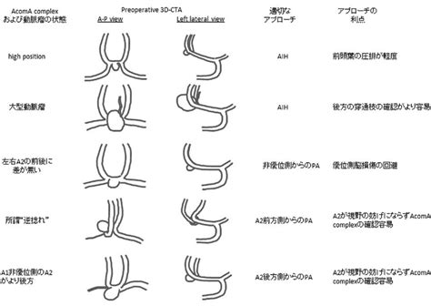 Schematic Representation Of Selection Of Surgical Approach For Acoma