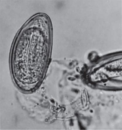 Pinworm Under Microscope