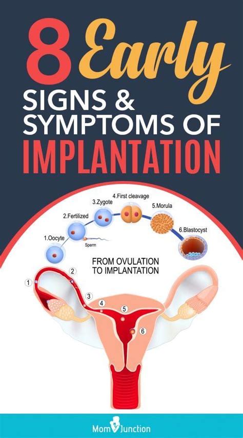 8 Early Signs And Symptoms Of Pregnancy Implantation Artofit