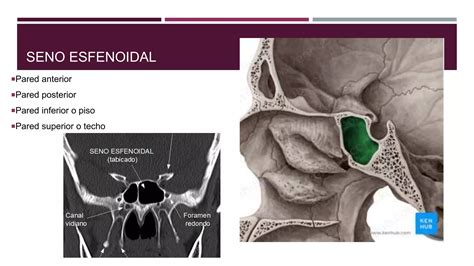 Nariz Y Senos Paranasales Anatomia PPT