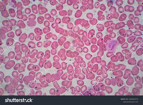 6,830 Blood Smear Microscope Royalty-Free Images, Stock Photos ...