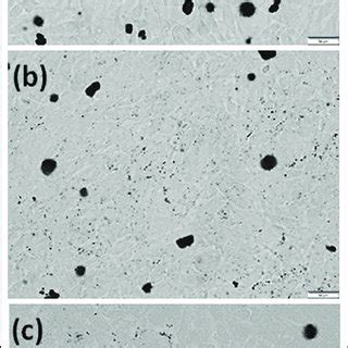 Light microscopy of Oil-Red-O stain (lipid accumulation) in D1-ORL-UVA ...