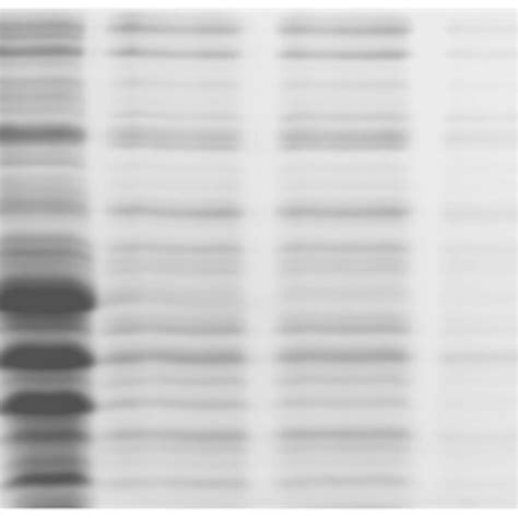 Overexpression Purification And Western Blot Analysis Of Recombinant