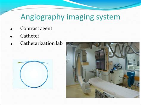 Ppt Angiography Powerpoint Presentation Free Download Id 5177574