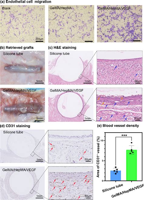 In Vitro And In Vivo Angiogenesis Of Gelma Hepma Vegf Scaffold A