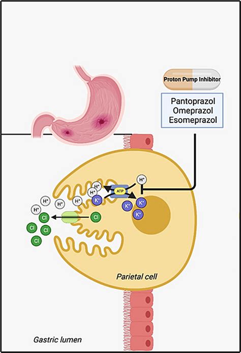 Proton Pump Inhibitors Weighing The Benefits And Risks Across Various