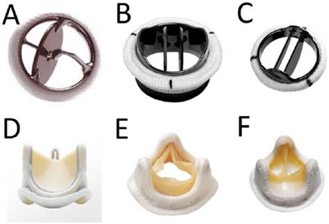 Prosthetic Heart Valves Circulation 42 OFF