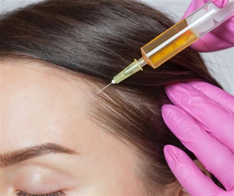 Platelet Rich Plasma Hair Restoration Anti Aging And Hair Restoration