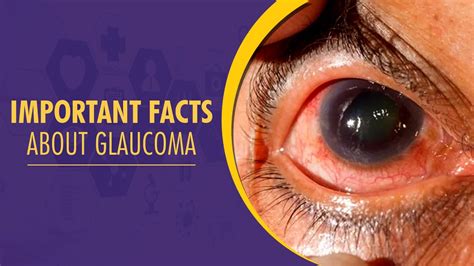 Important Facts About Glaucoma By Dr Harsh Kumar Centre For Sight Youtube