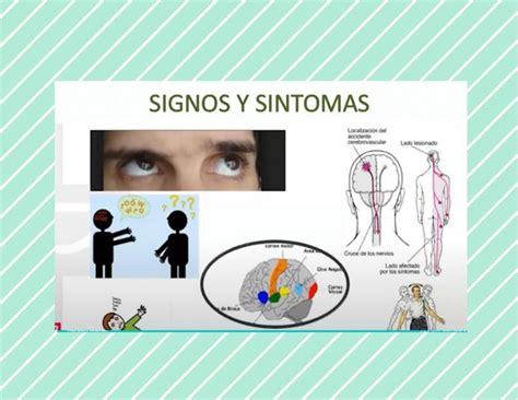 Signos y síntomas Alxnsx s uDocz