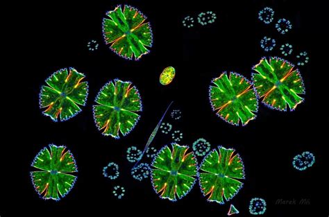 Various Desmids Under the Microscope, Micrasterias, Closterium ...