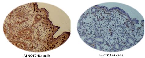 Representative Immunohistochemical Staining For CD117 And NOTCH1