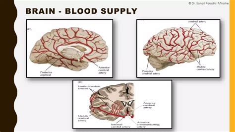 Neonatal Intracranial Hemorrhage By Dr Sonali Mhatre Ppt