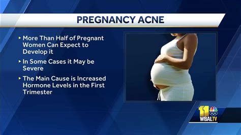 How to deal with acne during pregnancy