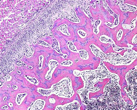 Endochondral Ossification Photograph By Jose Calvo Science Photo