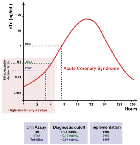 History Of Tn Sensitivity REBEL EM Emergency Medicine Blog