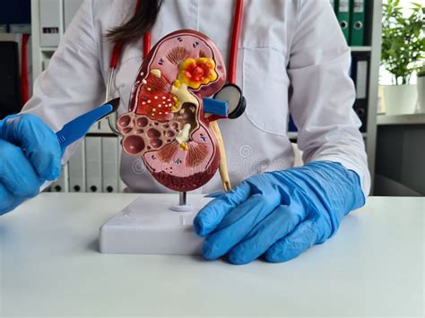 Cirurgia De Rins E Glândulas Suprarrenais é Intervenção Cirúrgica