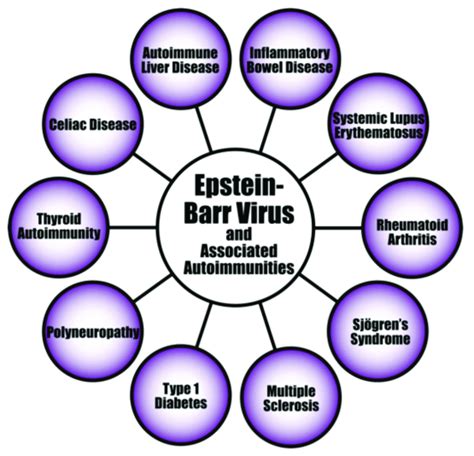 Epstein Barr Virus And A Few Of Its Associated Autoimmune Diseases Download Scientific Diagram