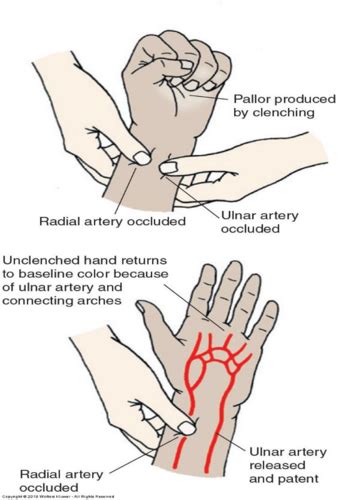 Hemodynamics Flashcards Quizlet