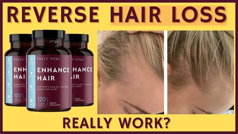 Fully Vital Enhance Hair Reviews Hair Loss Treatment Enhance Hair