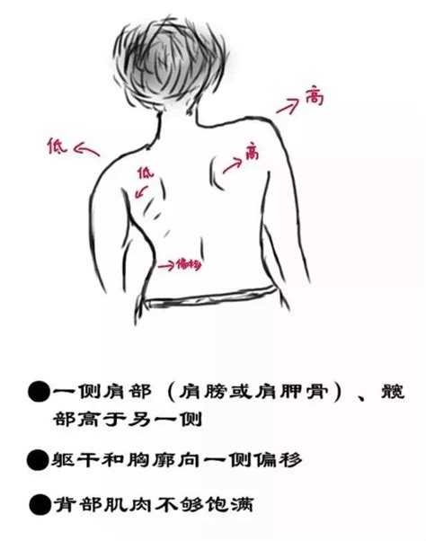 別讓孩子的未來毀在「脊柱側彎」上，快來看看你家孩子脊柱是否健康 每日頭條