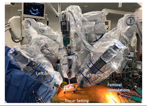 Figure 1 From Early Clinical Experiences Of Robotic Assisted Aortic