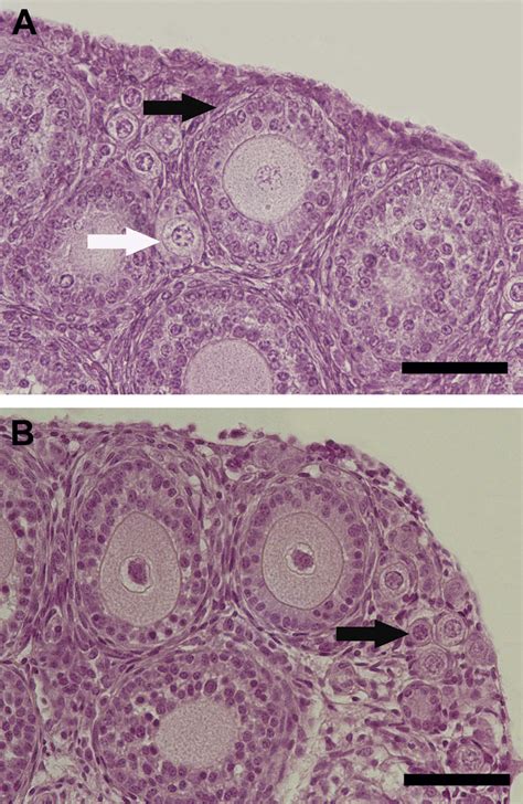 Mouse Preantral Follicle Development In Two Dimensional And Three Dimensional Culture Systems