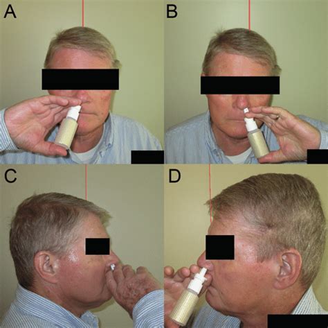 Photo Documentation Of A Patient Administering Nasal Spray Into His