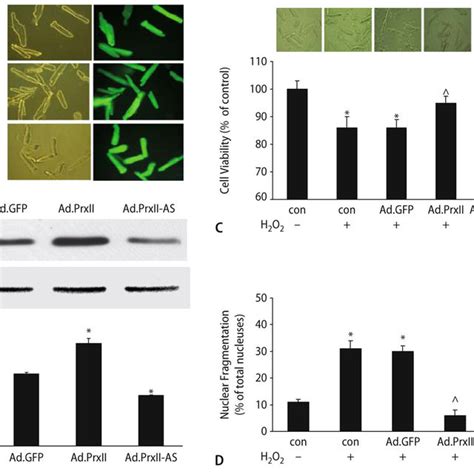 Effects Of Peroxiredoxin Ii Prxii Overexpression And Downregulation