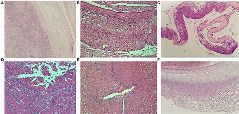 Placental Membranes Histology