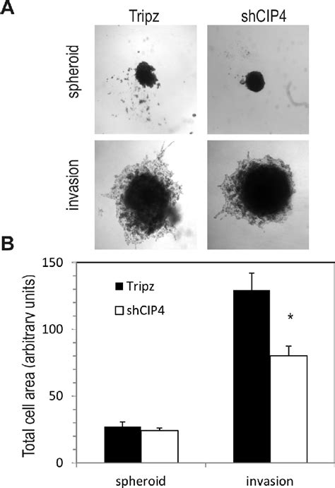 Cip4 Promotes Tnbc Cell Invasion A Representative Phase Contrast