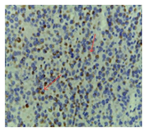 Bcl Bax And Caspase Protein Expressions In Nude Mouse Xenografts