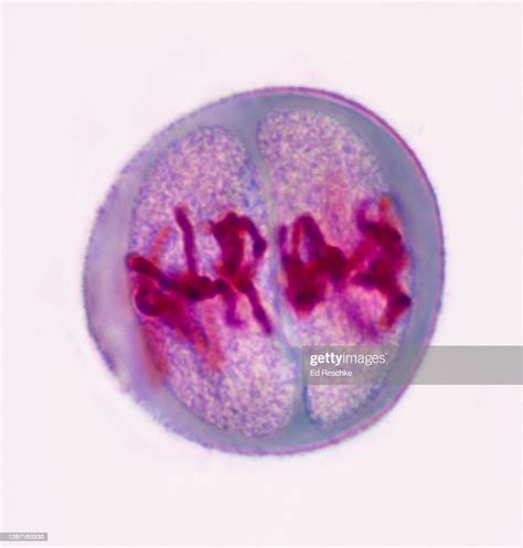 Metaphase 2