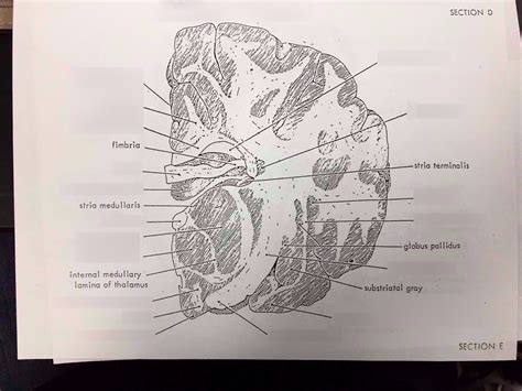 Sheep Brain Coronal Cut E Diagram Quizlet