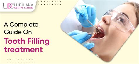 Know In Detail About The Tooth Fillings Procedure And Its Material Types