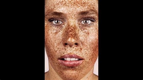 Photographer Captures The Beauty Of Freckles In All Their Glory Artofit